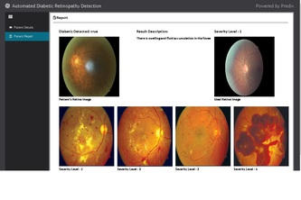 Trojan - Automated Diabetic Retinopathy Detection